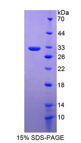 蛋白信号调节因子19(RGS19)重组蛋白