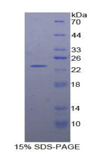 蛋白信号调节因子4(RGS4)重组蛋白