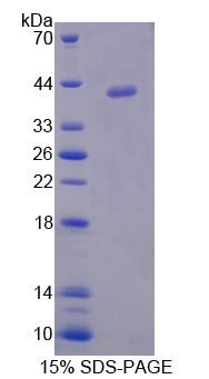 低密度脂蛋白受体衔接蛋白1(LDLRAP1)重组蛋白