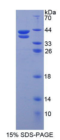 抵抗素样蛋白β(RETNLb)重组蛋白