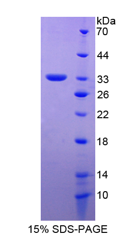 淀粉样蛋白β前体蛋白结合蛋白A2(APBA2)重组蛋白