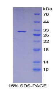 淀粉样蛋白β前体蛋白结合蛋白A3(APBA3)重组蛋白