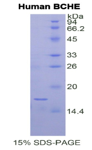 丁酰胆碱酯酶(BCHE)重组蛋白