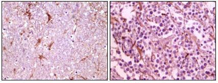 CIB1 antibody [5A1F5E12, 5A1H7E12]