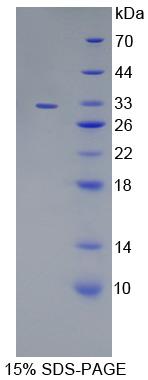 多胺调节因子1结合蛋白1(PMFBP1)重组蛋白