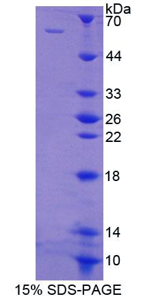 多聚嘧啶区结合蛋白1(PTBP1)重组蛋白