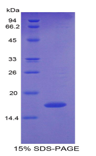 多型性腺瘤基因样蛋白1(PLAGL1)重组蛋白