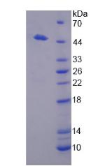 二肽酶1(DPEP1)重组蛋白