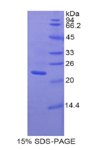 泛连接蛋白1(PANX1)重组蛋白