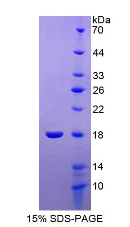 泛素结合酶E2C结合蛋白E2I(UBE2I)重组蛋白