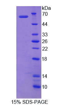 泛素特异性肽酶14(USP14)重组蛋白