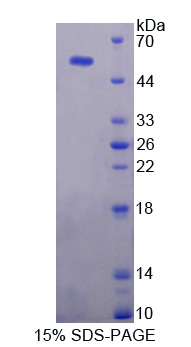 泛素特异性肽酶7(USP7)重组蛋白