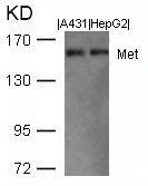 c-Met antibody