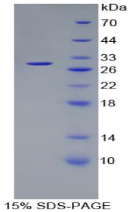 非ATP酶蛋白酶体26S亚基10(PSMD10)重组蛋白