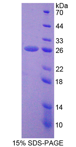 非ATP酶蛋白酶体26S亚基5(PSMD5)重组蛋白