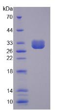 非红细胞血影蛋白β4(SPTbN4)重组蛋白