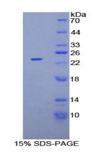 非转移细胞3表达NM23A蛋白(NME3)重组蛋白