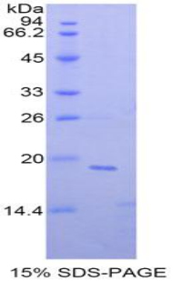 非转移细胞4表达NM23A蛋白(NME4)重组蛋白