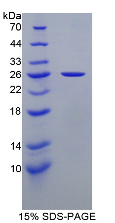 非转移细胞5表达NM23A蛋白(NME5)重组蛋白