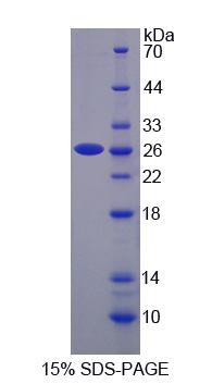 分拣连接蛋白17(SNX17)重组蛋白