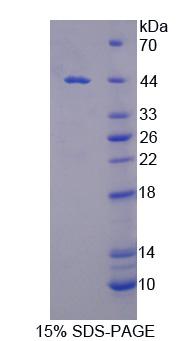 分拣连接蛋白9(SNX9)重组蛋白