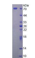 分泌粒蛋白Ⅱ(SCG2)重组蛋白