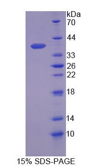 分泌球蛋白家族2A成员2(SCGB2A2)重组蛋白