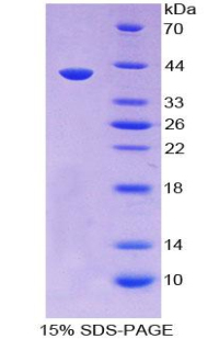 分泌球蛋白家族3A成员1(SCGB3A1)重组蛋白