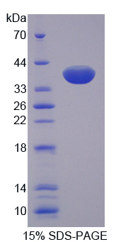 分泌型卷曲相关蛋白1(SFRP1)重组蛋白