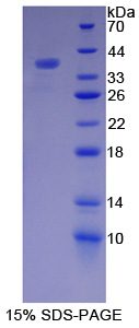 辅肌动蛋白α4(ACTN4)重组蛋白