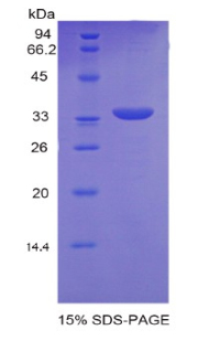 副肿瘤抗原MA2(PNMA2)重组蛋白