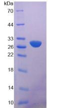 钙非依赖性磷脂酶A2(iPLA2)重组蛋白