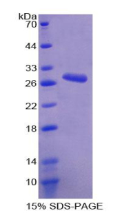 钙激活氯通道蛋白1(ANO1)重组蛋白