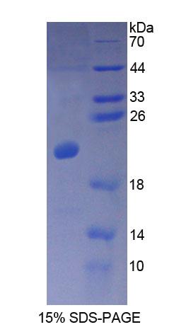 钙调蛋白样蛋白3(CALML3)重组蛋白
