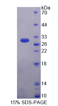 钙粘蛋白EGF LAG七经G-型受体3(CELSR3)重组蛋白