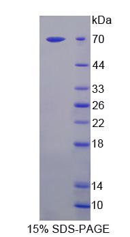 甘露糖苷酶α1A类成员1(MAN1A1)重组蛋白