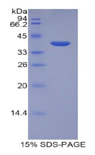 肝表达抗菌肽2(LEAP2)重组蛋白