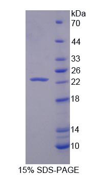 肝配蛋白A1(EFNA1)重组蛋白