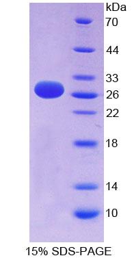 肝配蛋白A3(EFNA3)重组蛋白