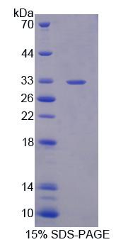 肝配蛋白A受体10(EPHA10)重组蛋白