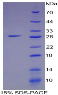 干扰素γ诱导蛋白16(IFI16)重组蛋白