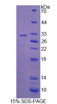 干扰素γ诱导蛋白30(IFI30)重组蛋白