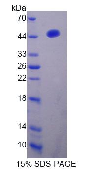 干扰素调节因子2(IRF2)重组蛋白