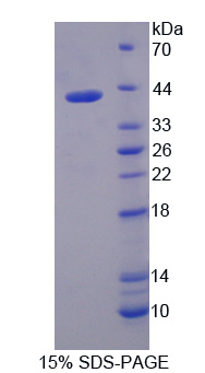 干扰素调节因子5(IRF5)重组蛋白