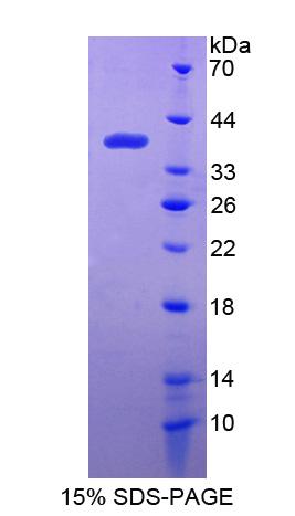 干扰素诱导蛋白35(IFI35)重组蛋白