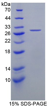 高密度脂蛋白结合蛋白(HDLBP)重组蛋白