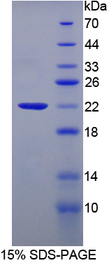 睾丸表达Amy1关联蛋白(AAT1)重组蛋白