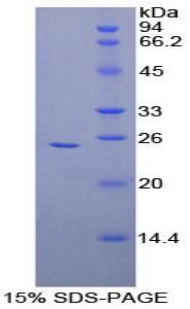 冠蛋白1A(CORO1A)重组蛋白
