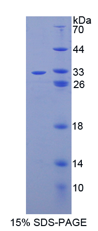 胱天蛋白酶14(CASP14)重组蛋白