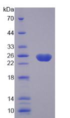 胱天蛋白酶8(CASP8)重组蛋白